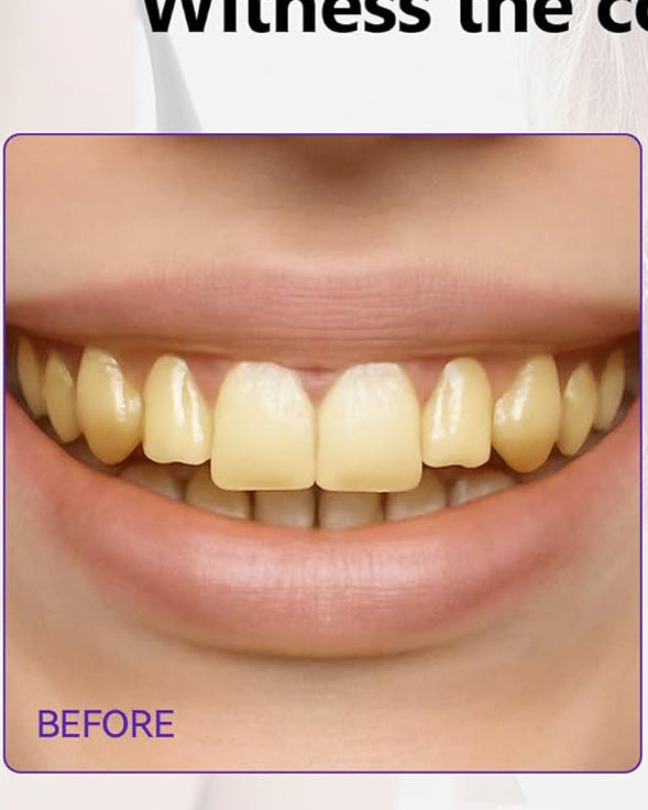 BrightSmile Daily Fast Whitening Strips